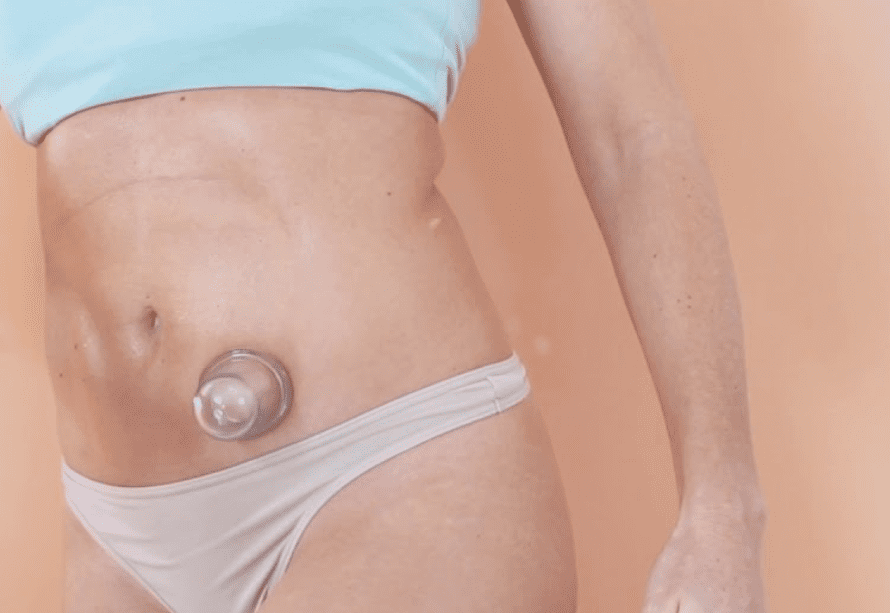 Valueras - Bankovanie Brucha