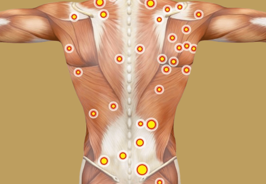 Valueras článok: Trigger point massage