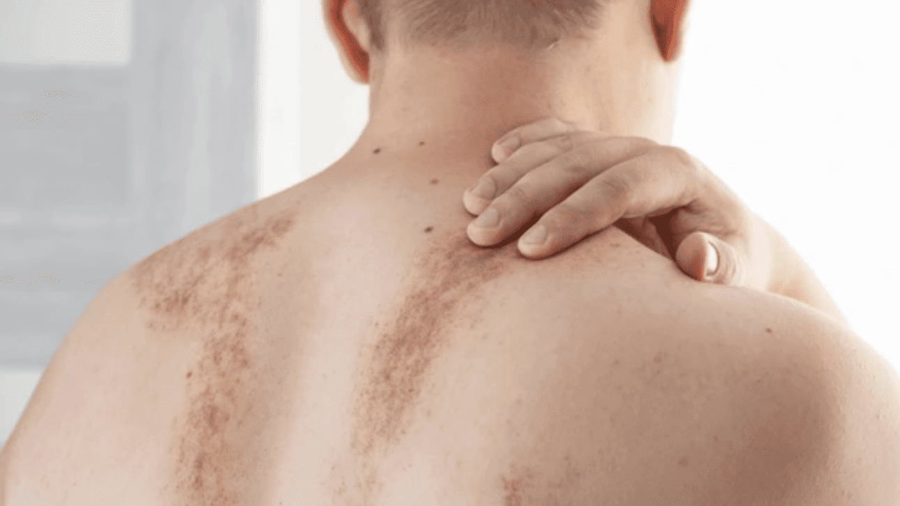 Valueras - Modriny po masáži