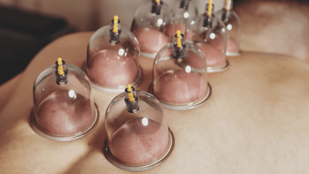 Valueras -bankovanie - modriny po masáži