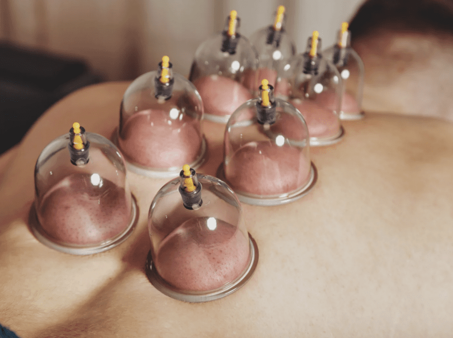 Valueras -bankovanie - modriny po masáži